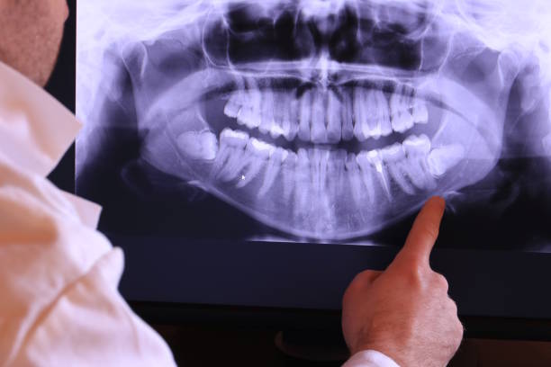 Best Emergency Root Canal Treatment in Pratt, KS